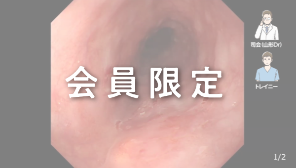Case 016 食道 中部食道 平坦陥凹性病変 サムネール