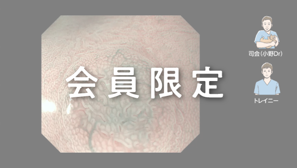 Case 017 胃 穹窿部大弯 隆起性病変 サムネール