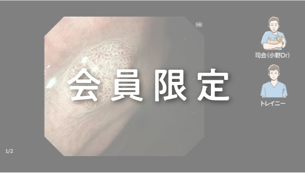 Case 021 胃 体部小彎 隆起性病変 サムネール