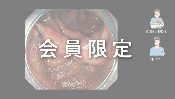 Case 023 十二指腸 下行部 平坦隆起性病変 サムネール