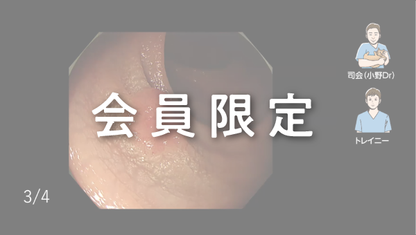 【会員限定】Case 024 大腸 ★★☆ 直腸 陥凹性病変（2026/03/27公開）