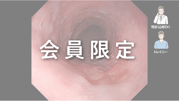 Case 025 食道 中部食道 陥凹性病変 サムネール