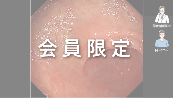 Case 026 胃 前庭部 陥凹性病変 サムネール