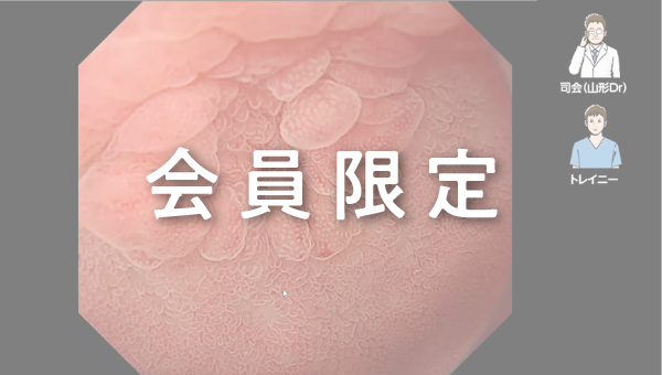 Case 028 十二指腸 球部 平坦隆起性病変 サムネール