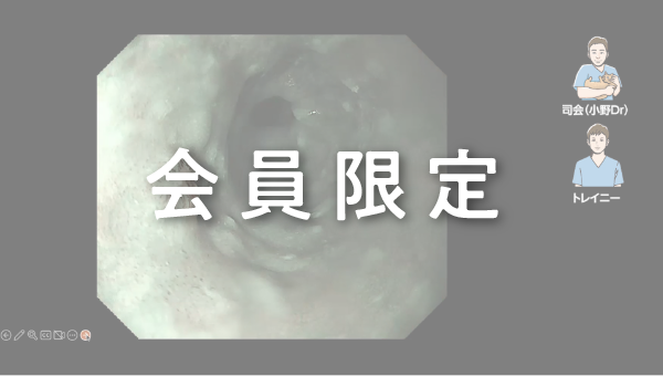 Case 029 食道 上部食道 隆起性病変 サムネール