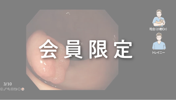【会員限定】Case 031 大腸 ★★☆ 直腸 隆起性病変（2026/06/12公開）