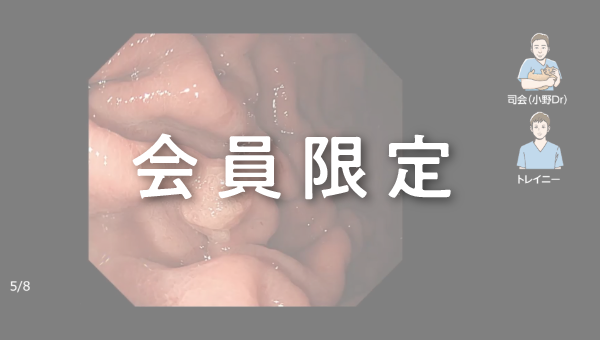 Case 032 胃 体部大弯 隆起性病変 サムネール