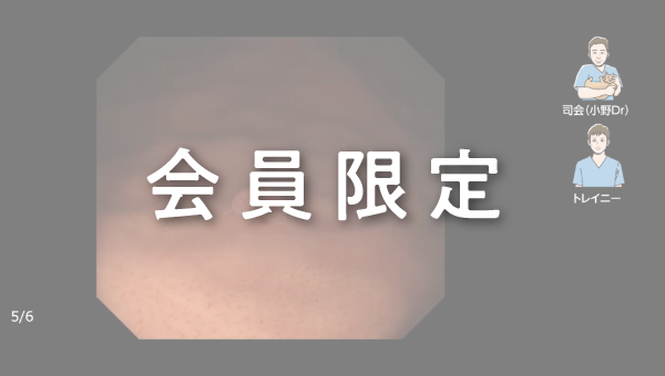 Case 033 胃 体部大弯 隆起性病変 サムネール