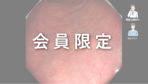 Case 034 大腸 直腸 平坦隆起性病変 サムネール