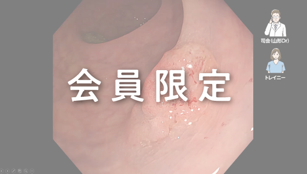 Case 037 大腸 直腸 隆起性病変 サムネール