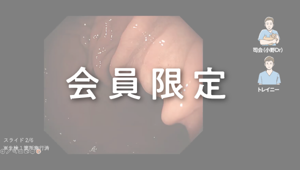 Case 038 胃 胃角 平坦病変 サムネール