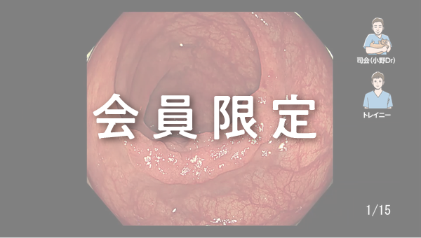 Case 042 大腸 横行結腸 陥凹性病変 サムネール