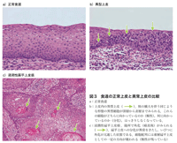 図3　食道の正常上皮と異常上皮の比較