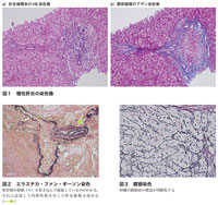 図1　慢性肝炎の染色像，図2　エラスチカ・ファン・ギーソン染色，図3　鍍銀染色
