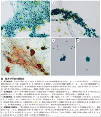 図　胆汁や膵液の細胞診