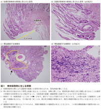 図1　検体採取時に生じる修飾