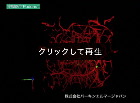 「Nestin-GFP形質転換マウス（神経幹細胞をGFPで標識）の歯状回を観察１」00:00:04（理化学研究所 脳科学総合研究センター 濱裕先生 宮脇敦史先生　ご提供 （パーキンエルマージャパン））