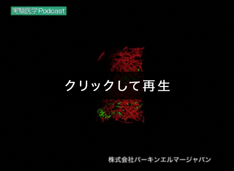 「Nestin-GFP形質転換マウス（神経幹細胞をGFPで標識）の歯状回を観察２」00:00:10（理化学研究所 脳科学総合研究センター 濱裕先生 宮脇敦史先生 ご提供 （パーキンエルマージャパン））
