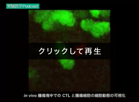 「in vivo腫瘍塊中でのCTLと腫瘍細胞の細胞動態の可視化」00:00:05（戸村道夫）