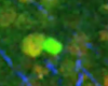 「in vivo腫瘍塊中でのCTLによる腫瘍細胞傷害の可視化」00:00:07（戸村道夫）