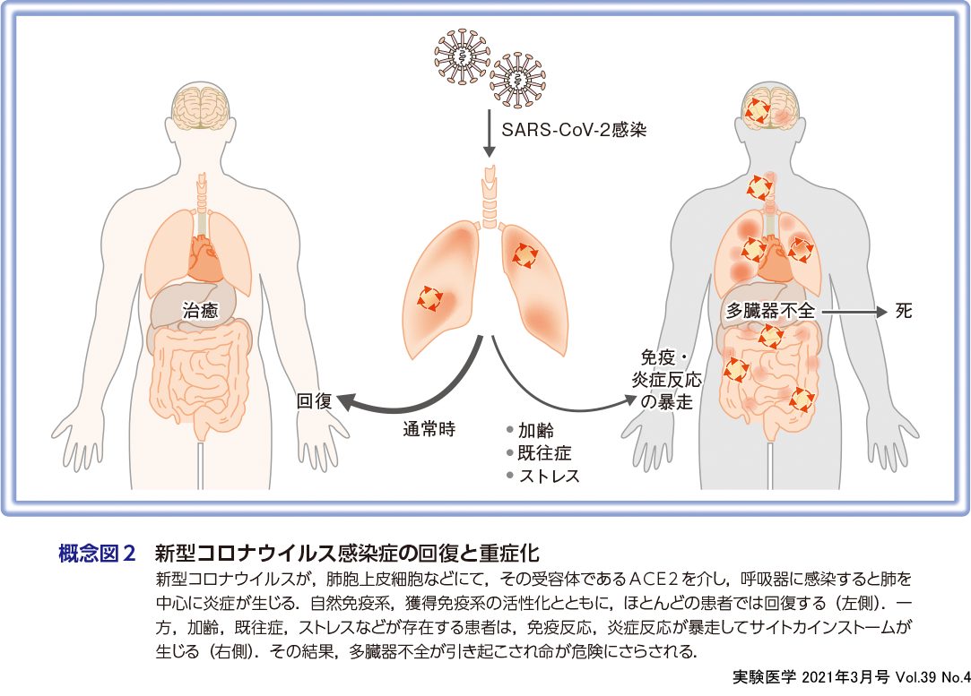 実験医学：免疫系の暴走 サイトカインストーム〜多様な疾患で生じる