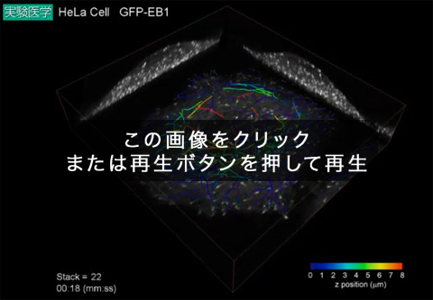 EB1-GFPを発現する間期HeLa細胞の3Dタイムラプス像とEB1コメットの3Dトラッキング