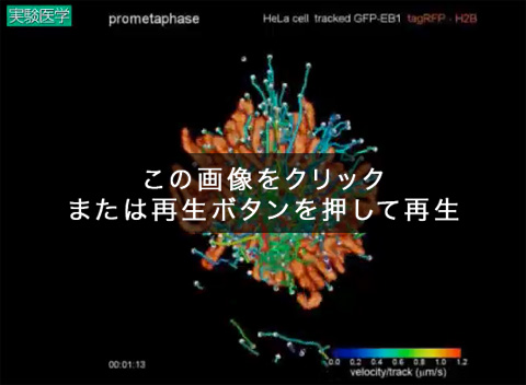 EB1-GFPとH2B-TagRFPを発現する分裂期HeLa細胞の、EB1-GFPの3Dトラッキング（ボールと線）と染色体の表面レンダリング（オレンジ）