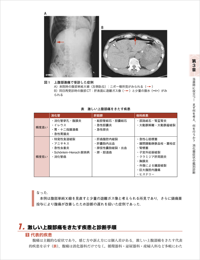 消化器診療の疑問、これで納得！　立ち読み2