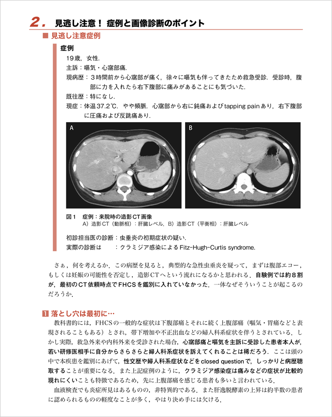 レジデントノート増刊 見逃さない！救急CTの読み方　立ち読み2