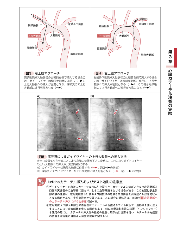 改訂版 確実に身につく心臓カテーテル検査の基本とコツ　立ち読み3