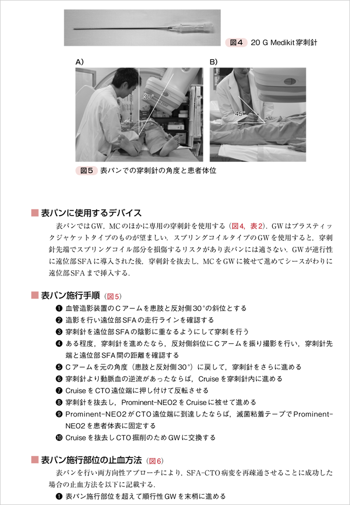 Rutherford´s VASCULAR SURGERY格段に上手くいくEVT 直販ショッピング