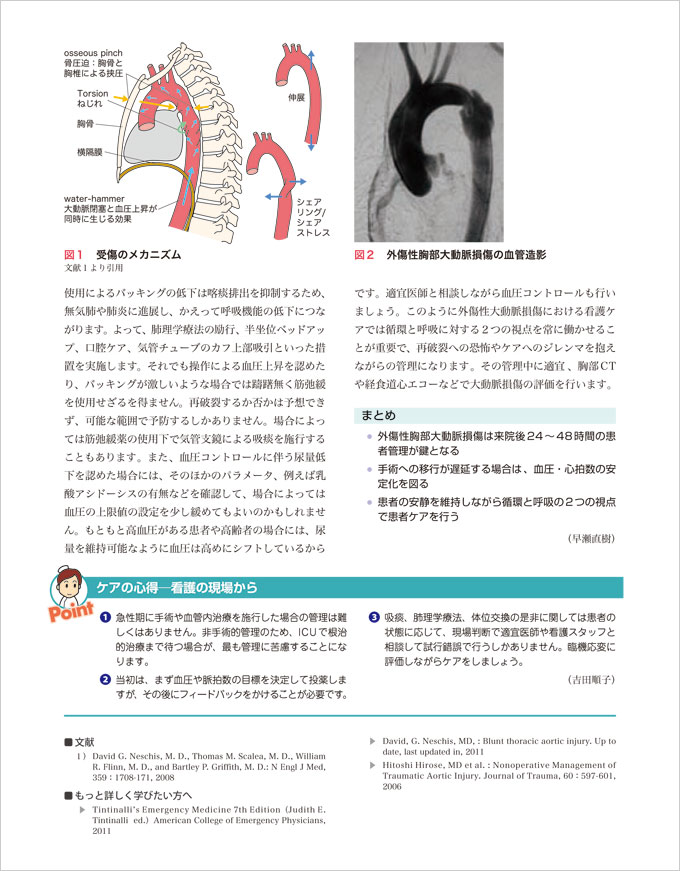 ICU看護パーフェクト　立ち読み6