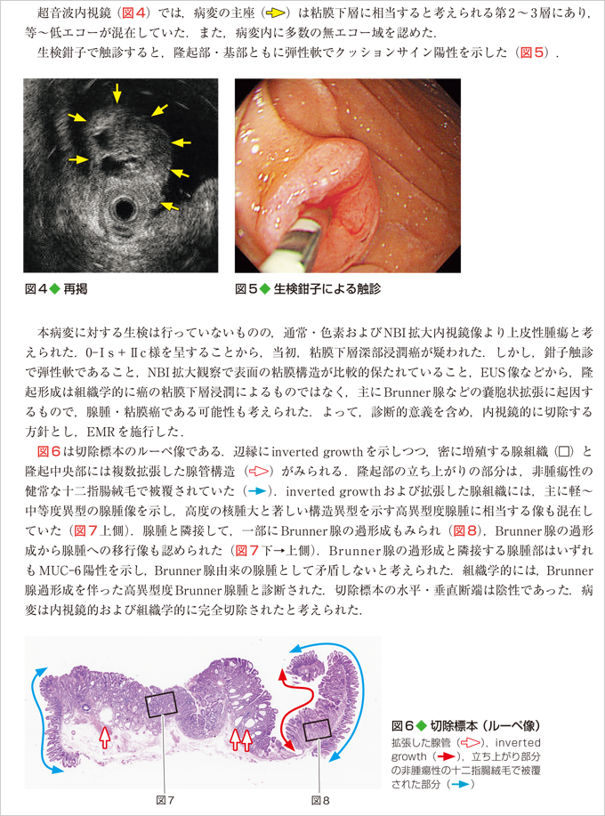 食道・胃腫瘍診断改訂版　立ち読み3