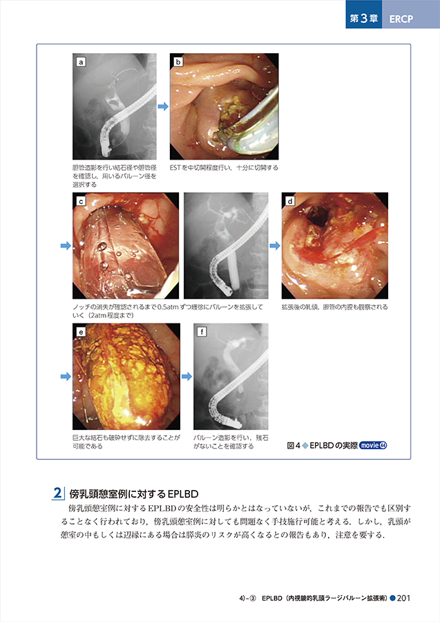 胆膵内視鏡の診断・治療の基本手技　第3版　立ち読み4