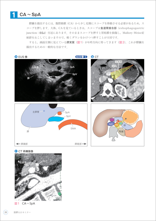 胆膵EUSセミナー〜CT・シェーマ・動画と合わせてわかる手技の基本から 