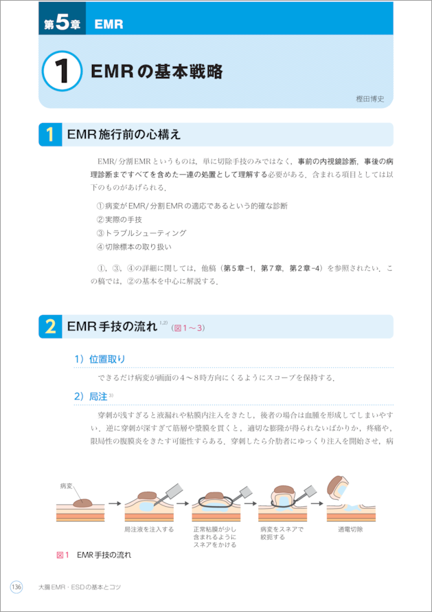 大腸EMR・ESDの基本とコツ〜エキスパートならではの治療手技・戦略を 