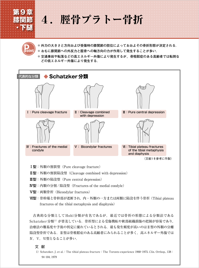 救急 当直で必ず役立つ 骨折の画像診断 改訂版 全身の骨折分類のシェーマと症例写真でわかる読影のポイント 羊土社