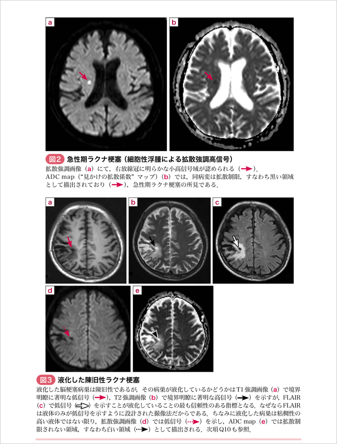 MRIに絶対強くなる撮像法のキホンQ&A　立ち読み2