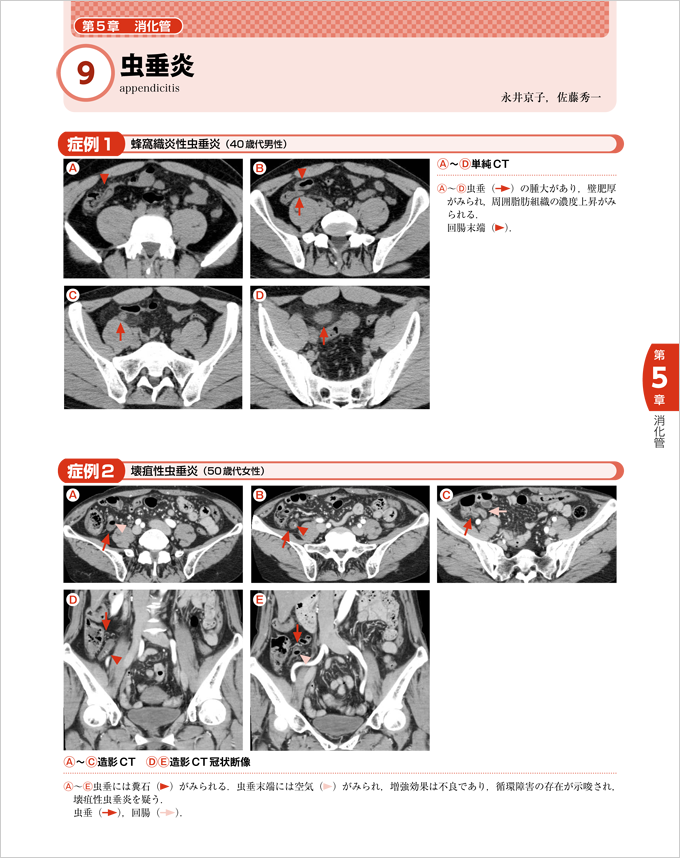 腹部疾患画像アトラス　立ち読み1