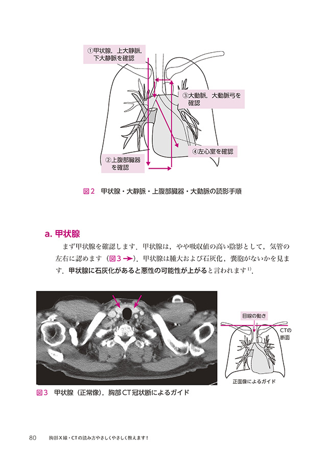 X線CTの読み方　立ち読み3