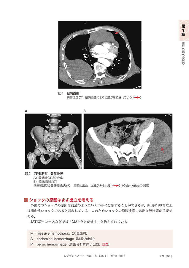 外傷の診かた　重症でも軽症でも迷わず動ける！　立ち読み3