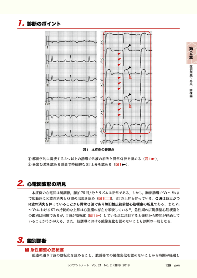 レジデントノート増刊：心電図診断ドリル〜波形のここに注目！ - 羊土社