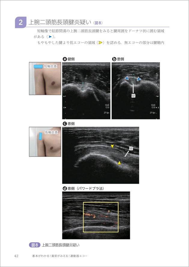 基本がわかる！異常がみえる！運動器エコー