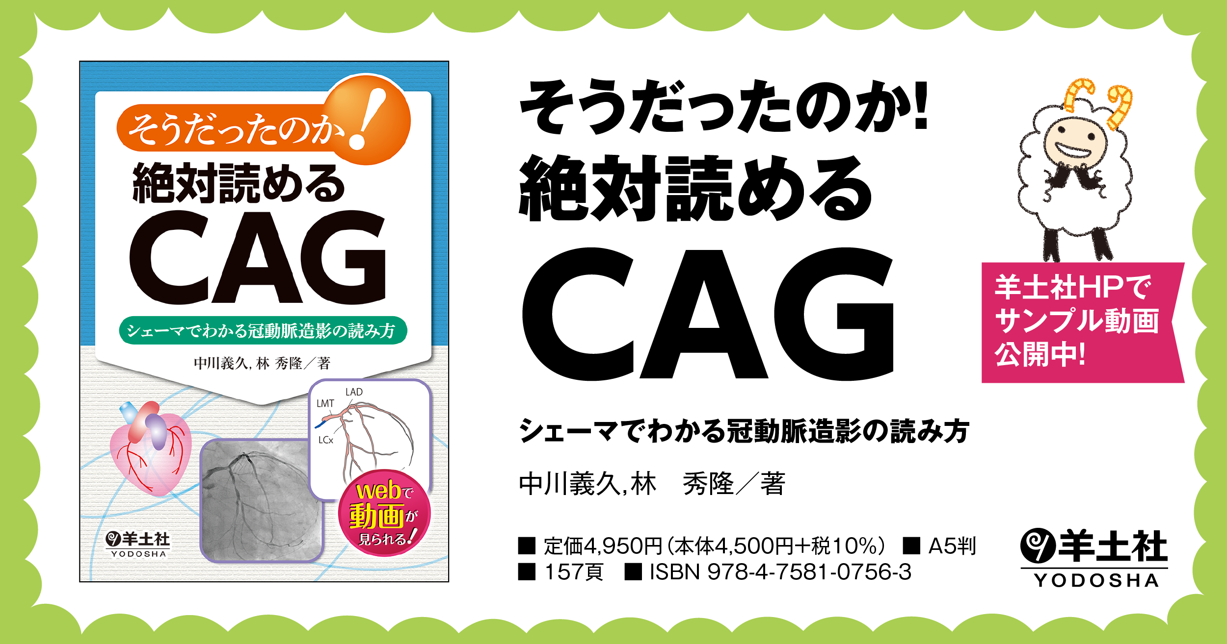 動脈造影の種類