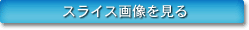 スライス画像を見る