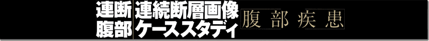 連断腹部　連続断層画像ケーススタディ【腹部疾患】