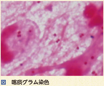 図　 喀痰グラム染色