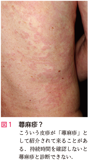 春の研修医応援企画 ドリル祭り21 プライマリケアと救急を中心とした総合誌 レジデントノートホームページへようこそ 羊土社 春の研修医応援企画 ドリル祭り21 プライマリケアと救急を中心とした総合誌 レジデントノートホームページへようこそ 羊土社