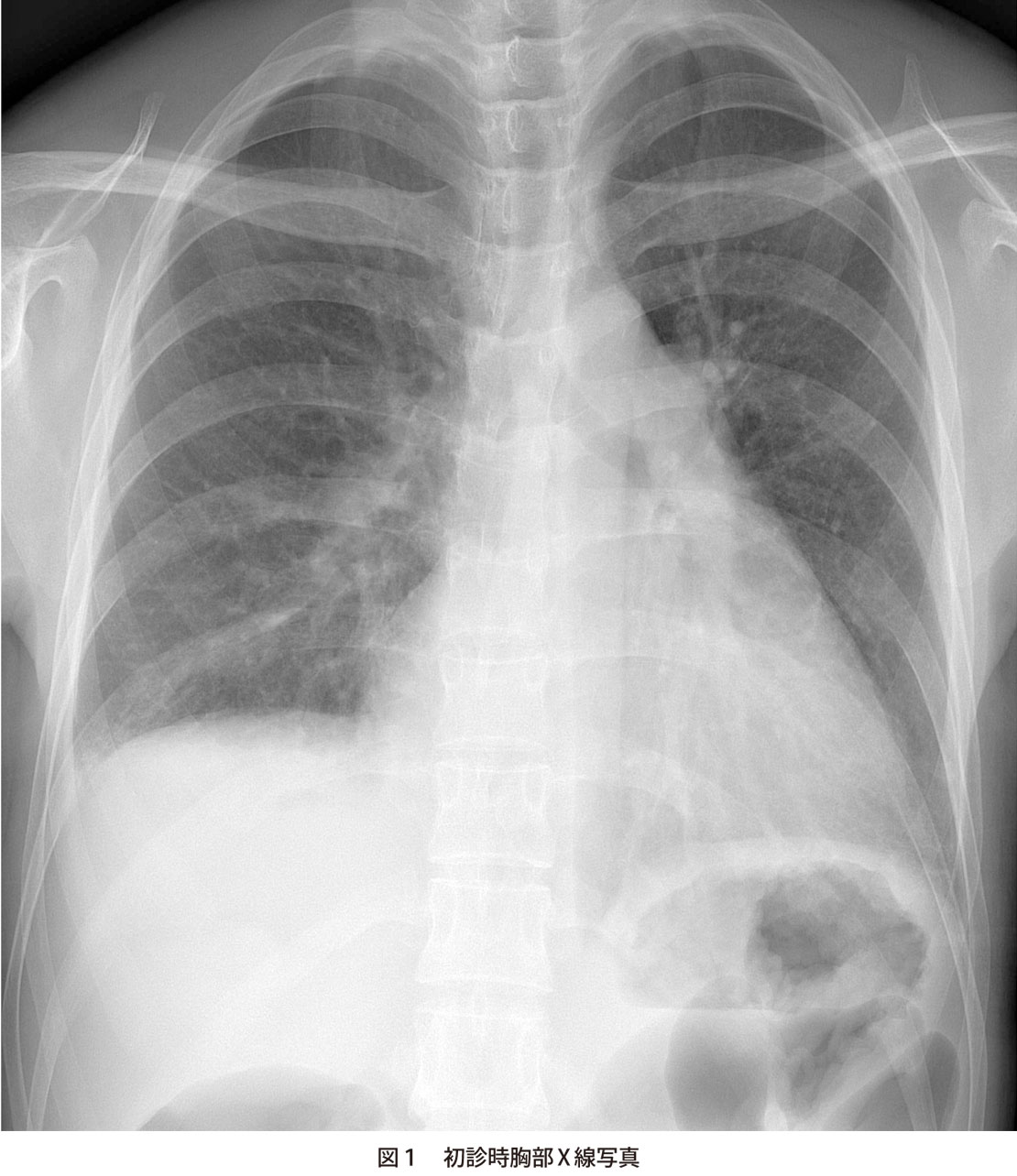 問題 呼吸苦 嗄声を主訴とする40歳代女性 実践 画像診断q A 羊土社 レジデントノート 実践 画像診断q A 羊土社 レジデントノート 羊土社
