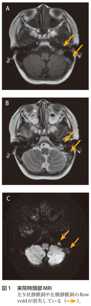 図1　来院時頭部MRI